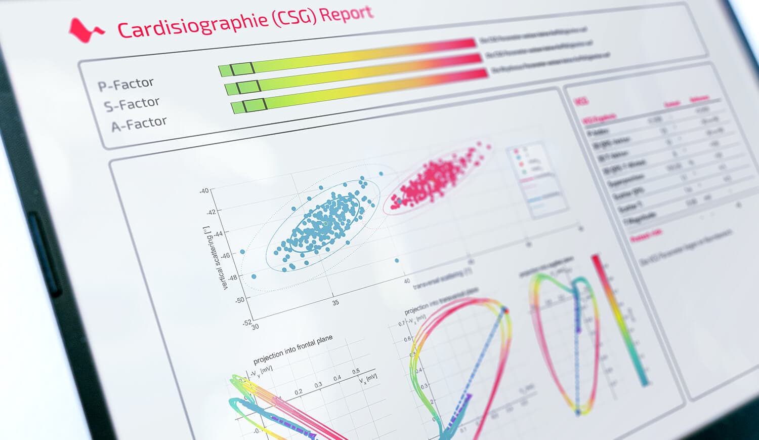 Tabletin ekranında bir Cardisiography raporu: P, S ve A faktör çubukları, saçılım grafiği ve vektör döngüleri